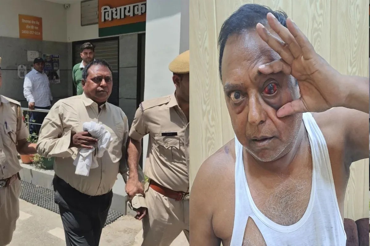राजस्थान में बीजेपी MLA पिटाई मामले में नया मोड़, इंजीनियर ने कहा- मुझे पाइपों से पीटा, आंख में लगी गंभीर चोट | Sriganganagar Mla Jaideep Bihani Accused Of Assault